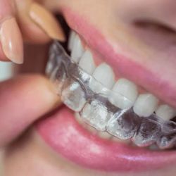 Beauty Clinics For Dark Circle