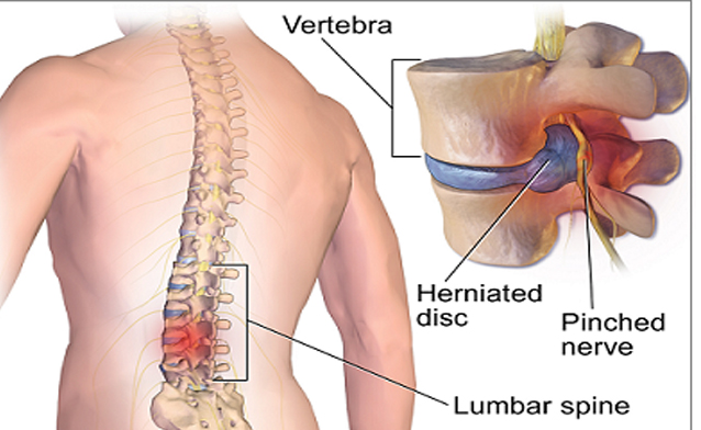 Spine Specialist Doctors